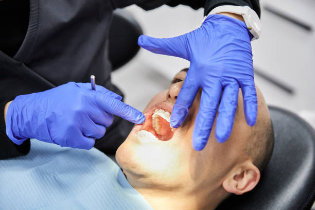 Best Emergency Care for Gum Disease in North Wilkesboro, NC